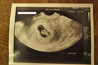 Babyfoto - Kopie.JPG